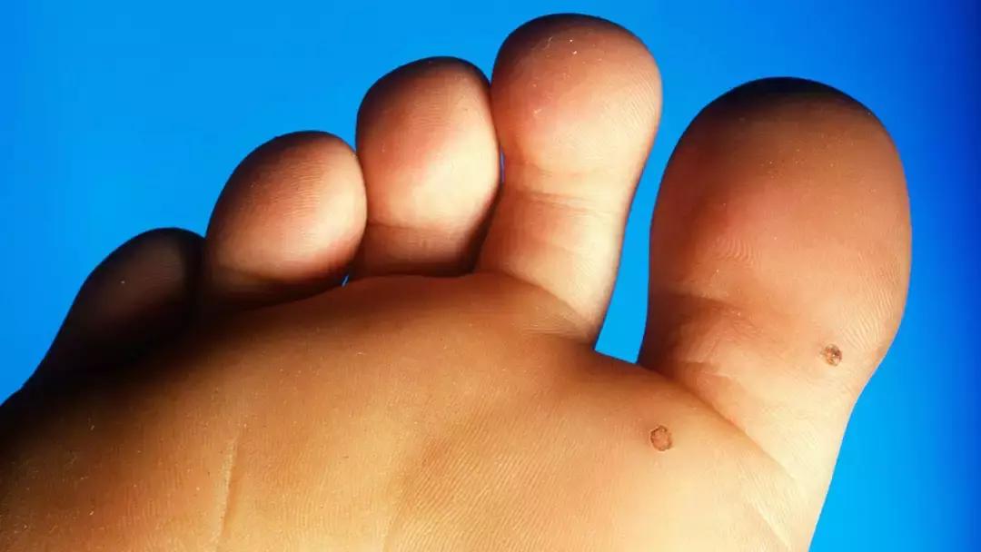 脚痛脚肿如何缓解疼痛,脚痛是什么原因引起的治疗方法