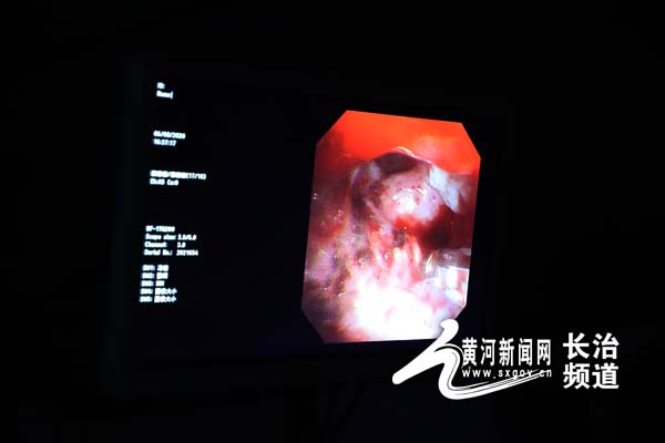 长治市人民医院项目,长治潞州市人民医院