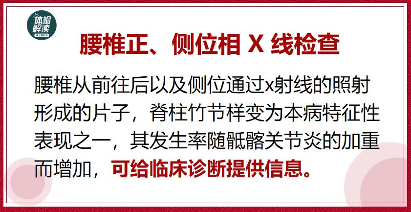 张嘉译得了强直性脊柱炎多少年了,张嘉译强直性脊柱炎的现状视频