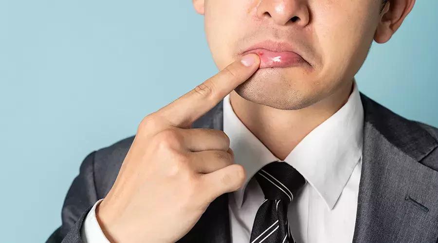 小孩口腔溃疡反复发作怎么回事,反复口腔溃疡经常上火吃什么药