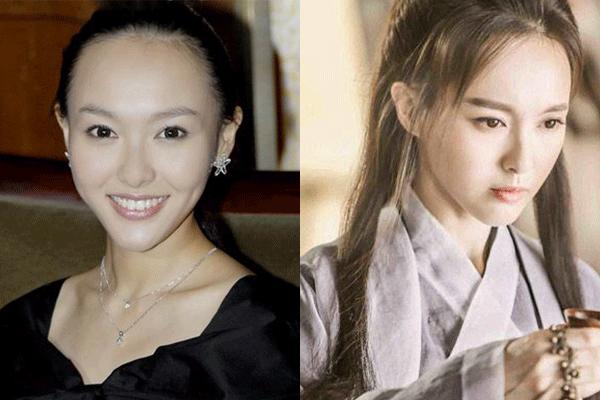 发际线高怎么办最快最有效,发际线高怎么办女孩