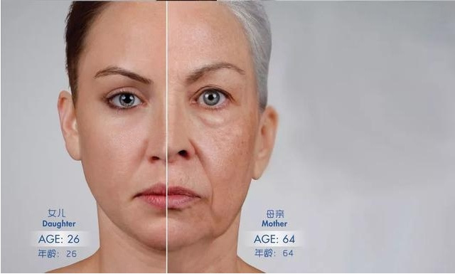 二十几岁法令纹特别明显是为什么,为什么比同龄人法令纹特别重