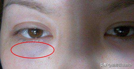 关掉美颜黑眼圈,关掉美颜眼睛更清纯