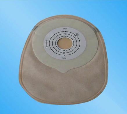 中国100万造口人：改道的肠子，改变的人生