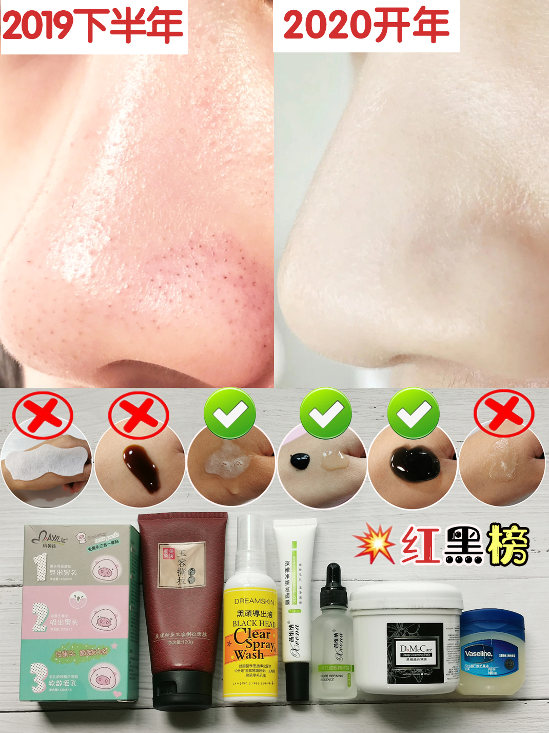 深层清洁去黑头产品推荐,去黑头清洁排行榜第一名