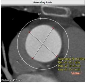 罗建方医生怎么样,罗建方教授