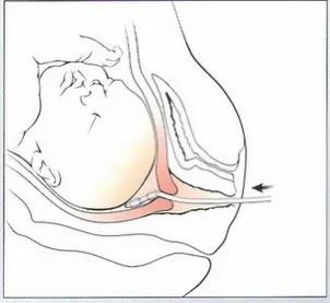 第26讲,催生方法有哪些?