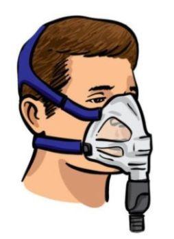 治疗打鼾的呼吸机怎么使用,呼吸机治打鼾效果怎么样