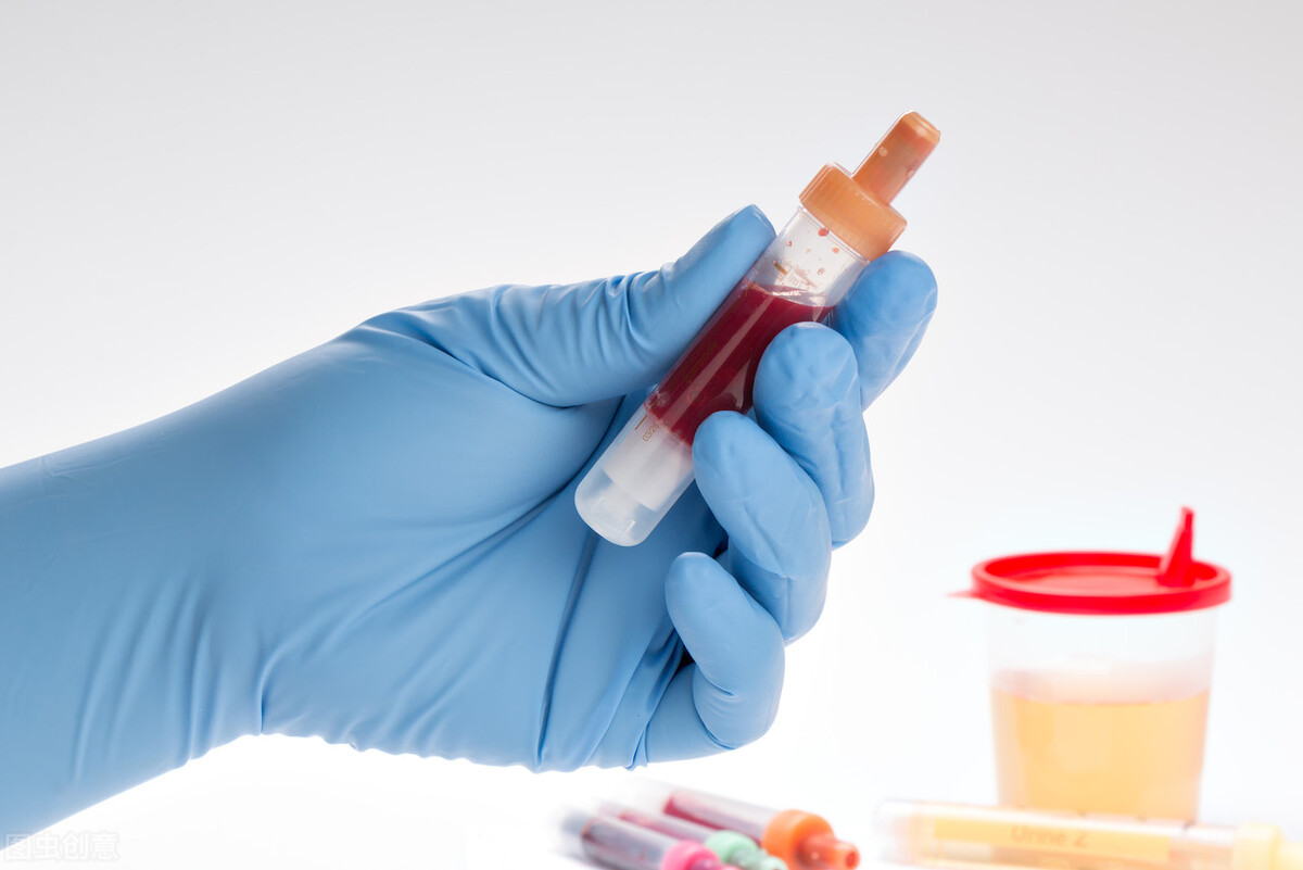 「患者咨询」听说肾炎“尿血”可以自愈,是真的吗?