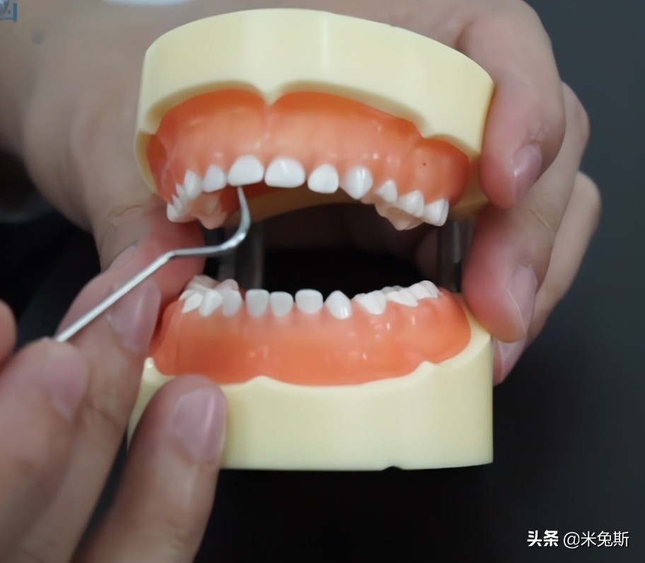 大家牙齿发育的怎么样,大家牙齿都长什么样