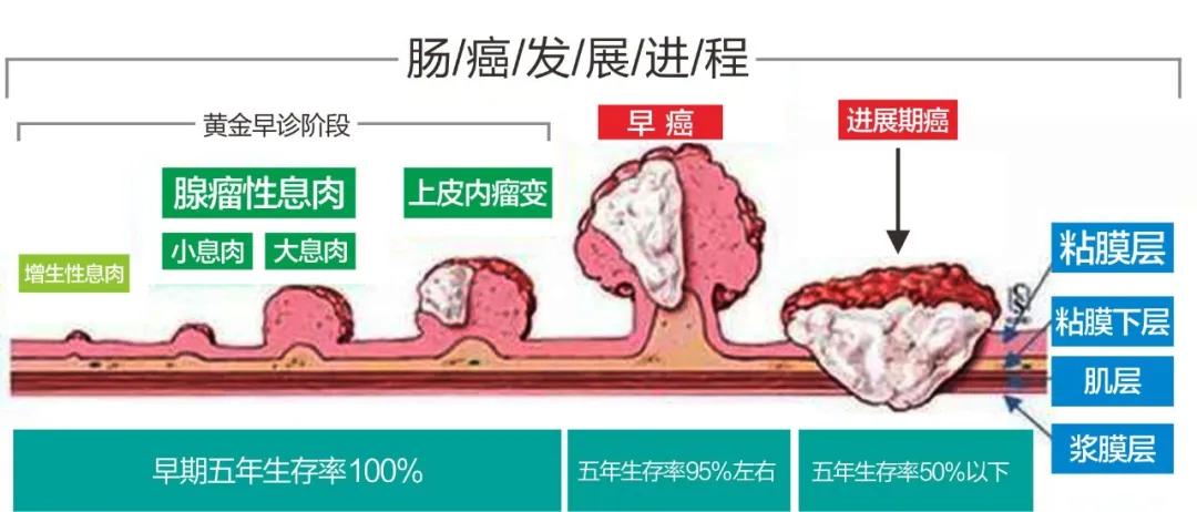 肛门瘙痒痔疮需要做肠镜吗,屁股不舒服痒怀疑痔疮