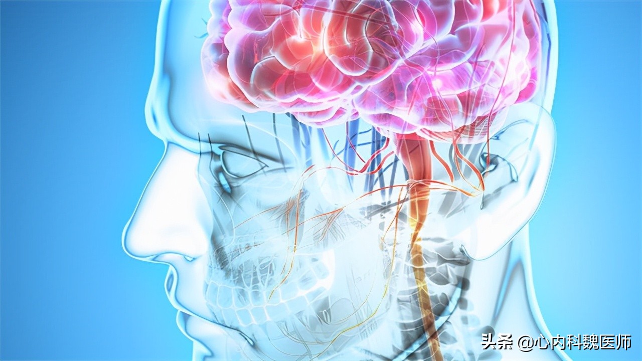 为何中国脑梗越来越多？医生：除了补充叶酸，做好这三点更重要