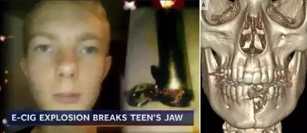 4000万人深受其害！这个100亿“伪健康”产业，正在毒害中国孩子