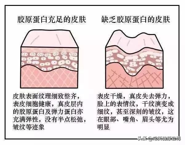 别再浪费胶原蛋白了,别再傻傻的补胶原蛋白了