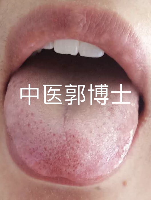 胸闷气短有痰中医怎么调理,胸闷气紧的经方