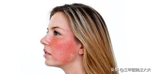 有些人脸红正常吗,老人心脏病脸红有危险吗