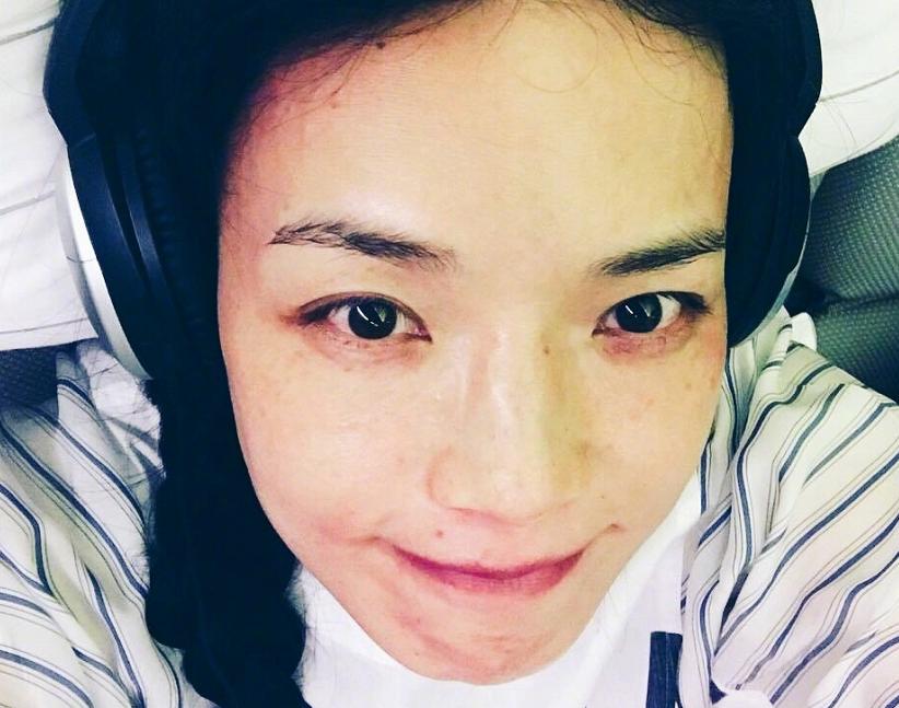 皮肤过敏好了之后怎么护肤,皮肤过敏怎么办最有效的办法