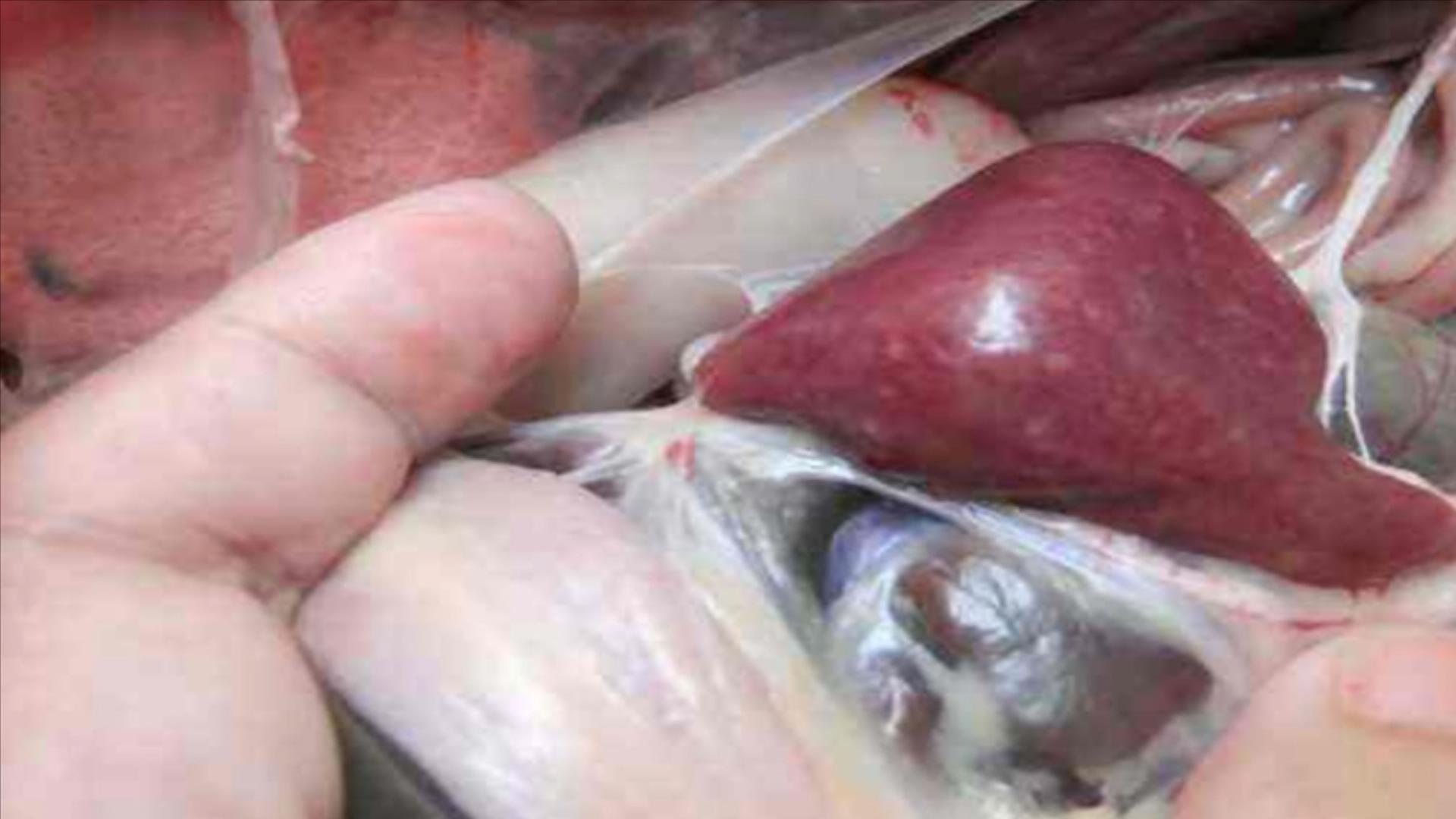 六种疾病不能吃鸡鸭,鸭有6个部位毒素最重建议要少吃