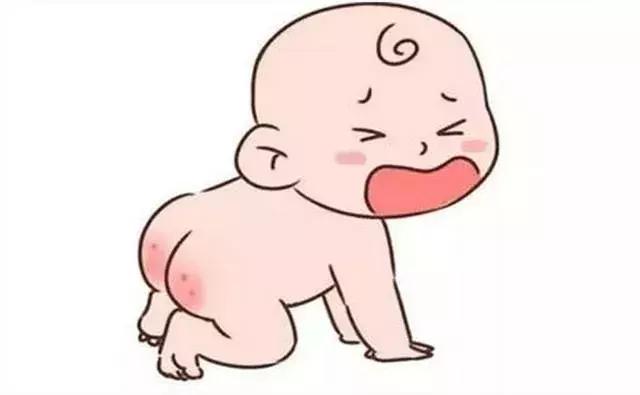 护臀膏有必要提前准备吗,护臀膏哪个效果最好最安全