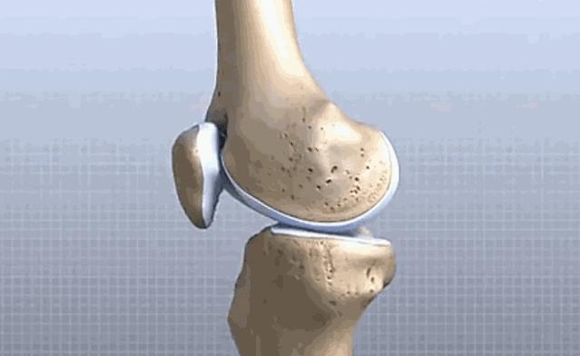 打封闭针可治骨关节炎吗,骨刺关节炎怎么治疗效果最好