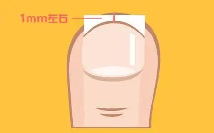 小知识一不小心扭伤脚了怎么处理,小脚趾指甲冷知识