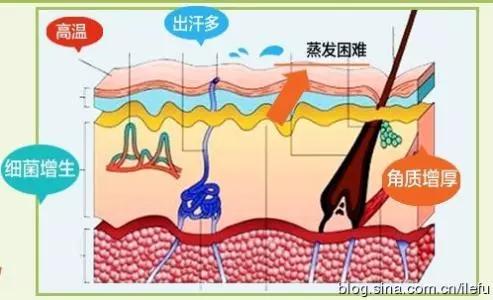 脚气发痒脚臭难忍,脚气治疗后一直痒