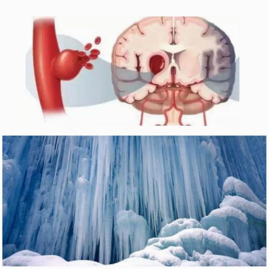 心脏病脑血栓都在什么时间发作,冬天脑血栓严重还是夏天严重