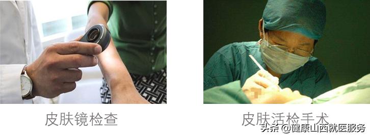 老年斑应该怎么预防,老年斑有办法预防