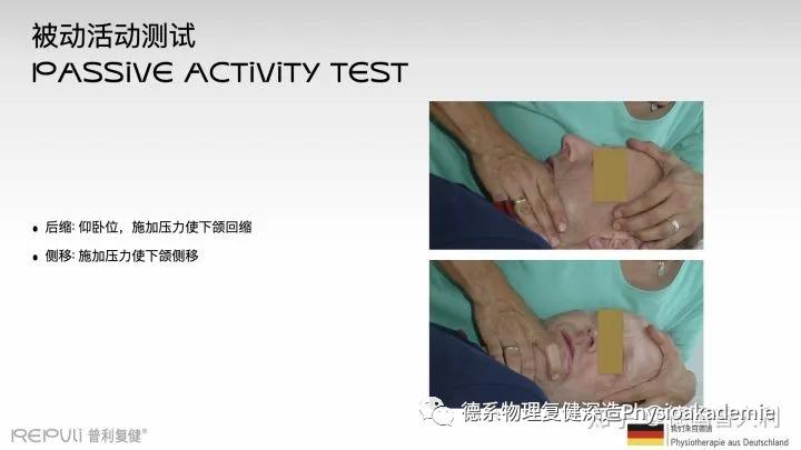 颞下颌关节紊乱综合征,颞下颌关节紊乱主要检查什么项目