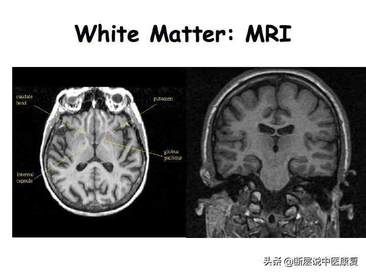中枢神经系统断层解剖讲解,中枢神经3d解剖动画