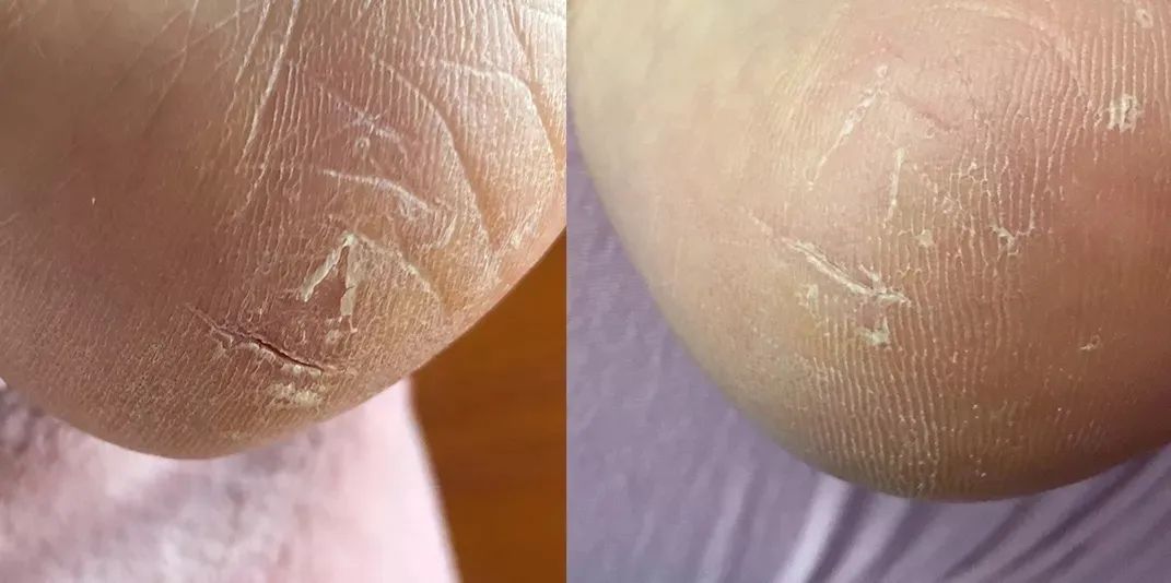 堪比大牌的平价乳霜,日本平价保湿面霜推荐