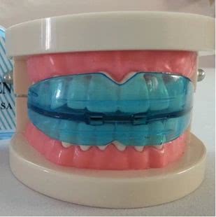 戴保持器期间要注意什么,戴了保持器要注意点什么