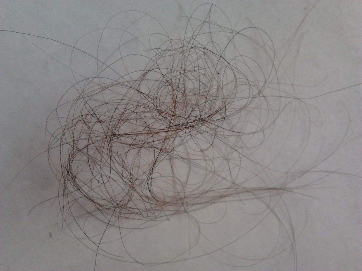 如何清理皮肤上口香糖,衣服粘口香糖怎么处理干净