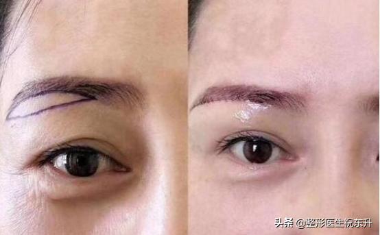 医生不会说的,医生不会说的秘诀