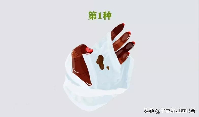 女士裤头有白带什么原因,女性裤头上带有褐色血渍什么原因