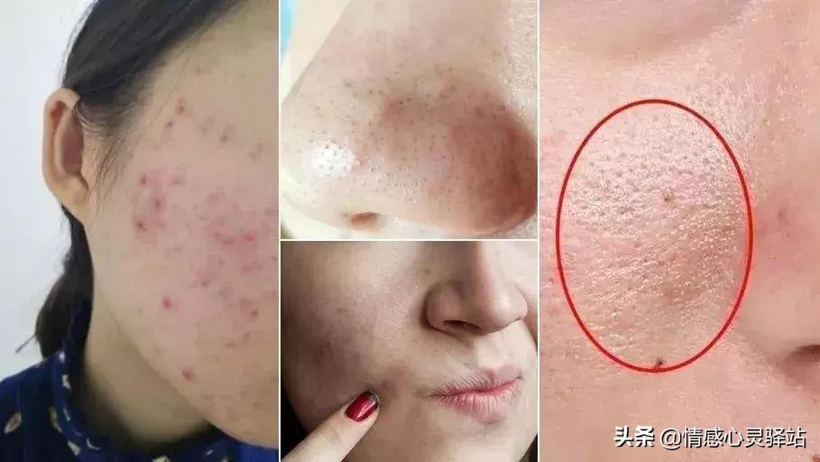 男女通用苦参净螨皂补水效果好吗,苦参皂一款全家都能用的万能皂