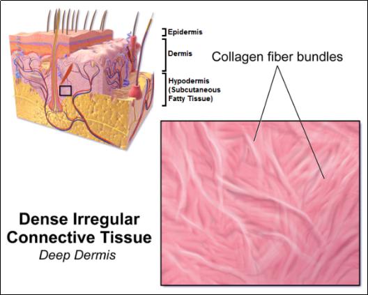 肥胖纹很严重怎么消除,有效去除肥胖纹的方法