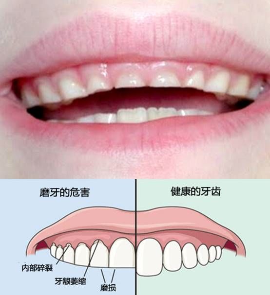 怎么判断小孩磨牙是有虫吃什么,小孩夜里磨牙是肚里有虫吗