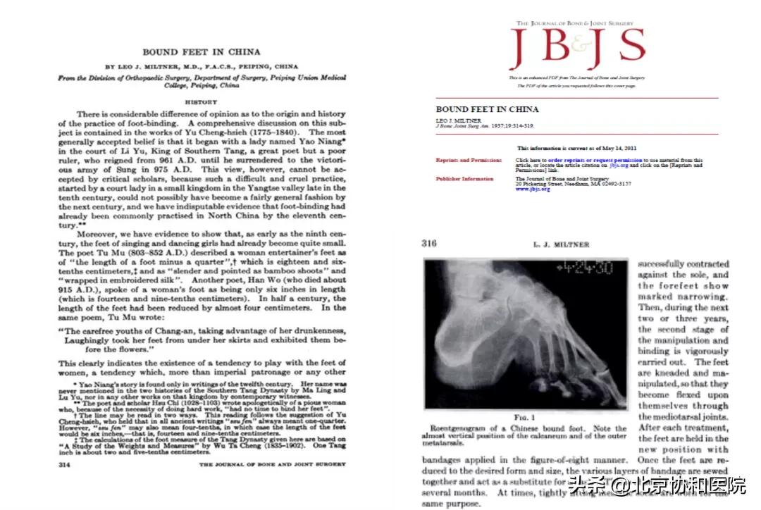仉建国协和骨科专家,仉建国脊柱侧弯矫正