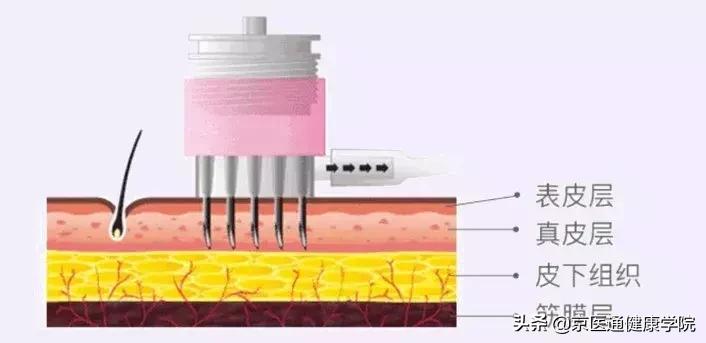 被吹上天却没什么用的保健品,被吹上天的阿胶