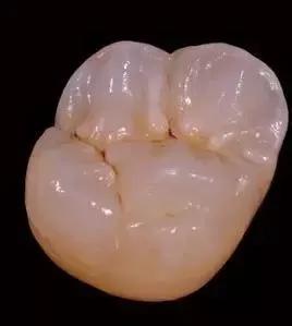 二氧化锆全瓷牙材料有哪些,二氧化锆烤瓷牙多少钱一颗