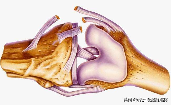 半月板撕裂膝盖弹响吃点什么药,半月板撕裂膝关节弹响