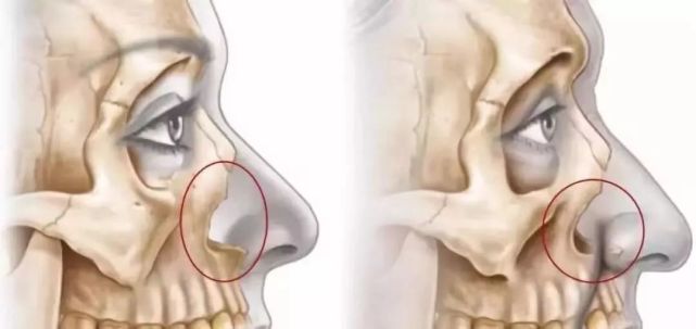 如何把法令纹变成一件高级的事