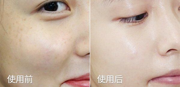 琚佸濮楄憽钀勭苯绮惧崕,琚佸濮楁帹鑽愯憽钀勭苯鎶よ偆