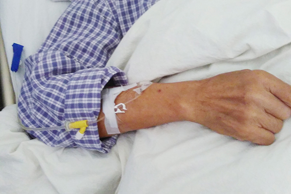 老年斑的形成原因及预防方法,老年斑的形成原因及去除方法