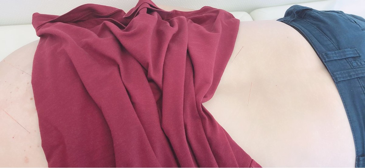 中医治疗肌无力的效果怎么样,中医治疗肌无力的好方子