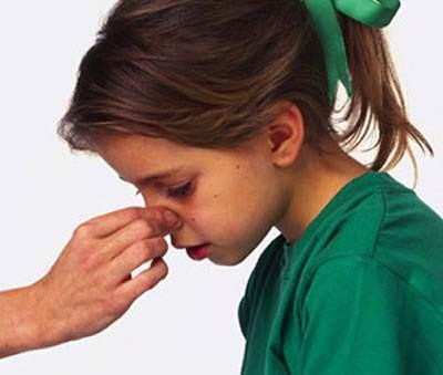 鼻窦炎可以经常用中药预防吗,有什么可以预防鼻窦炎的方法