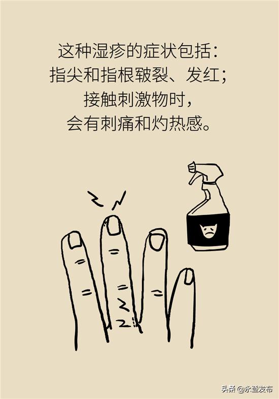 湿疹膏有哪些治疗效果好的,湿疹膏可以治愈吗