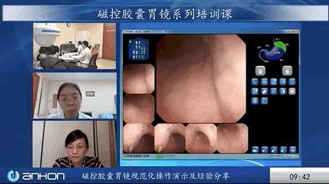 磁控胶囊肠胃镜流程,磁控胶囊胃镜是怎么操作的