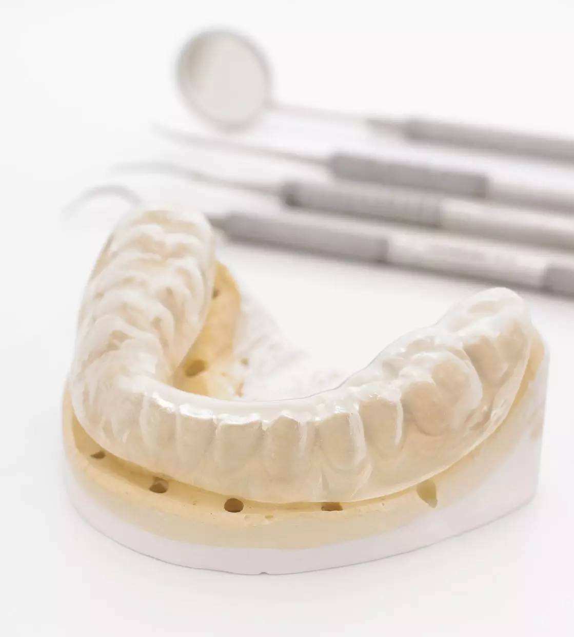 医院整牙矫正一般多少钱,成人整牙矫正需要多少钱